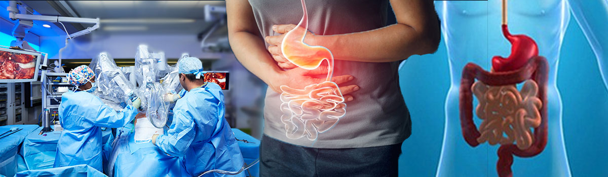 Doctor Consultation For Gastrointestinal Surgery Treatment In Delhi