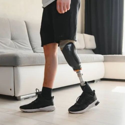 Artificial Limb Prosthesis Surgery India Low Cost Benefits