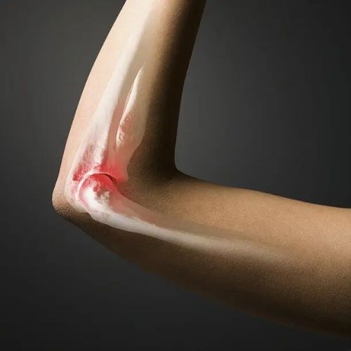 Bone Cancer Treatment and Surgery in India