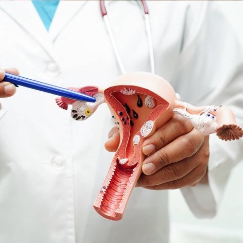What is Cervical Cancer