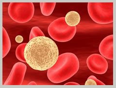 What are Alternatives to Colon Cancer Surgery?
