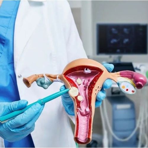 causes of fibroid