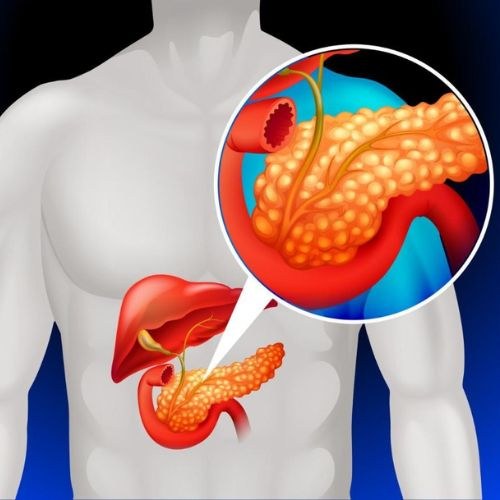 Low Cost Pancreatic Cancer Treatment and Surgery in India.
